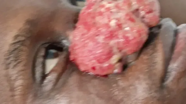 Aidons Etienne à se soigner - il lutte contre un cancer